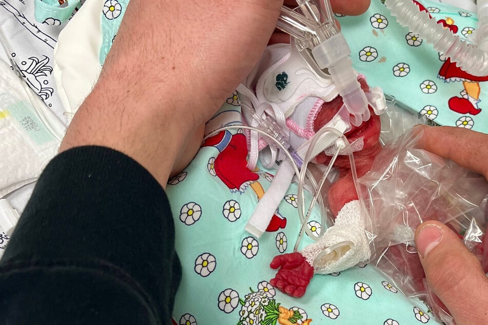 Mini-Baby mit 265 Gramm geboren: So geht es dem winzigen Wunder
