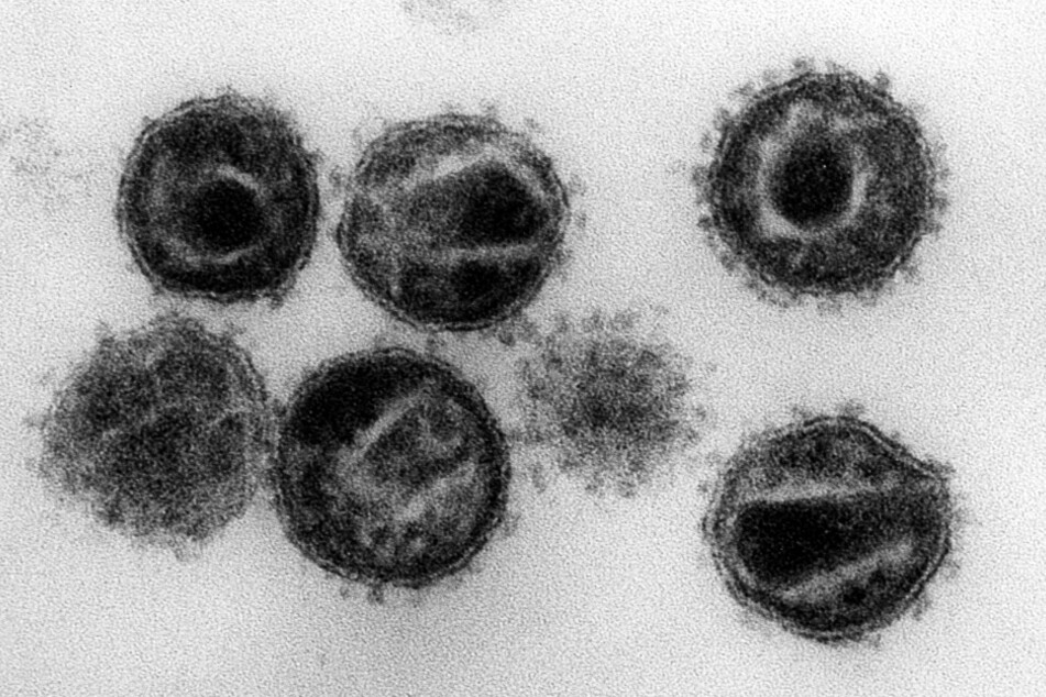Elektronenmikroskopische Aufnahme mehrerer HIV (Humane Immunschwäche-Viren) Erreger der Immunschwäche-Krankheit Aids.