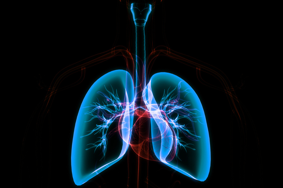 Tuberkulose befällt größtenteils die Lunge und die Fälle nehmen weltweit zu.