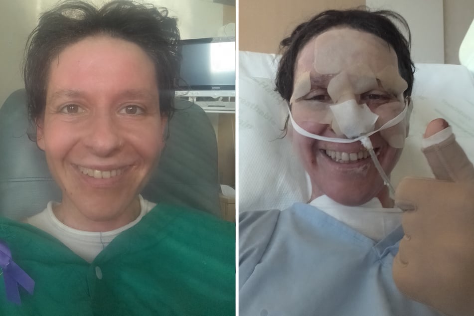Nach mehreren Wochen im Krankenhaus, Operationen und Hauttransplantationen hat sich die 41-Jährige überraschend gut erholt.
