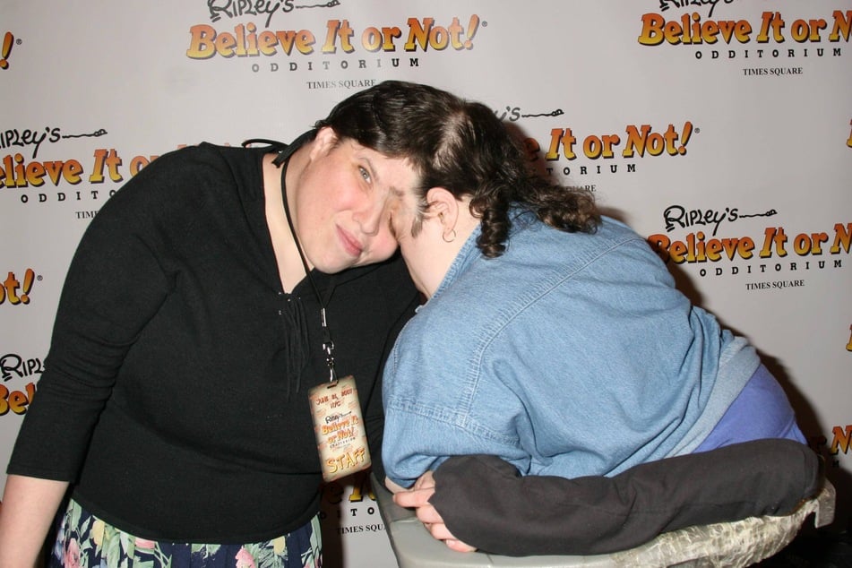 Lori i George Schappell (†62), najstarsze bliźniaki syjamskie na świecie, zmarli w 2024 roku.