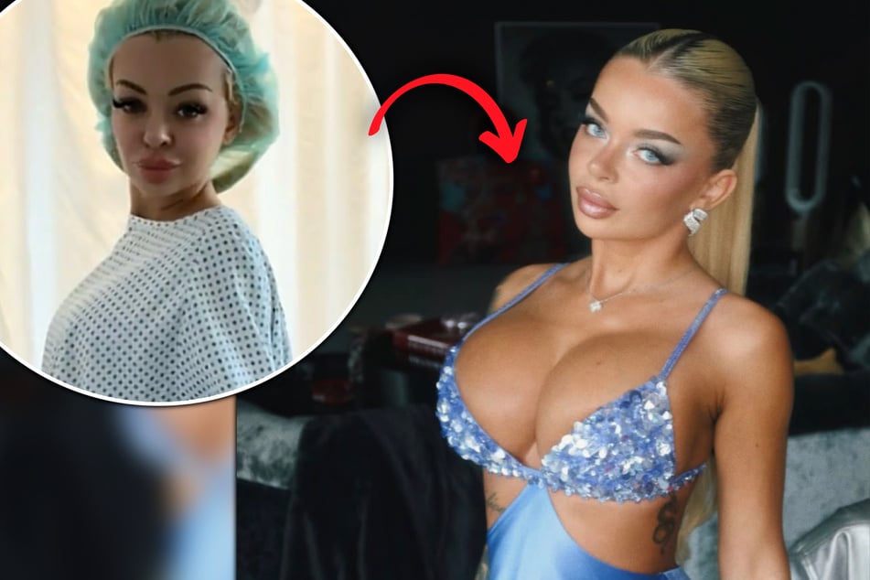 "Damit ich noch geiler aussehe": Katja Krasavice lässt sich Rippe für Beauty-OP entfernen