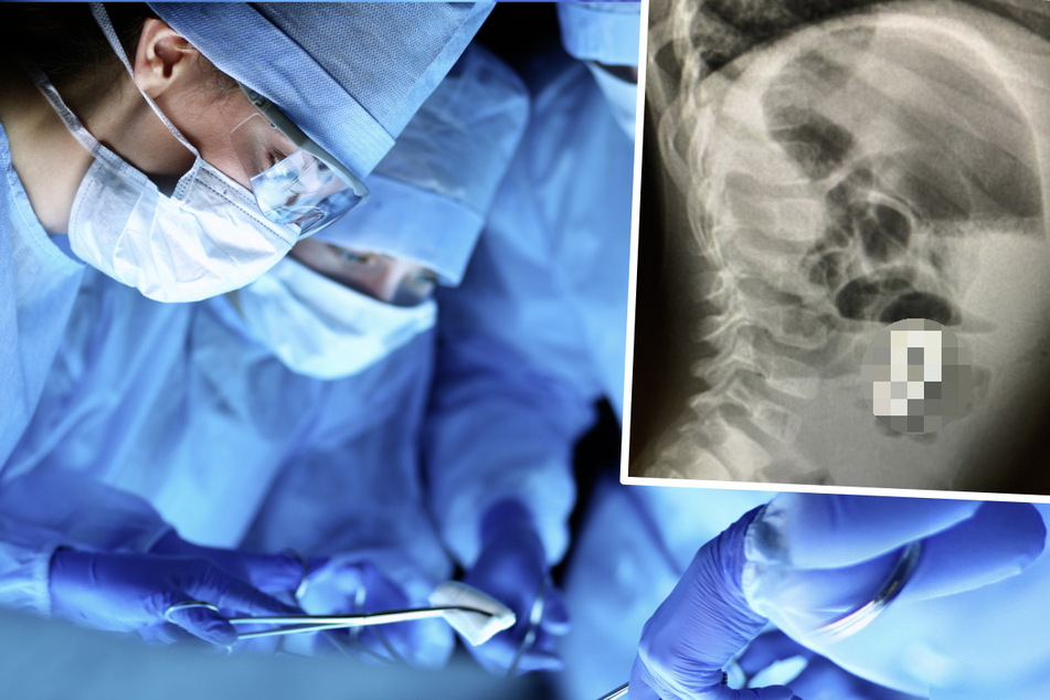 Kleinkind klagt über Bauchschmerzen: Als sich Ärzte das Röntgenbild ansehen, sind sie verblüfft