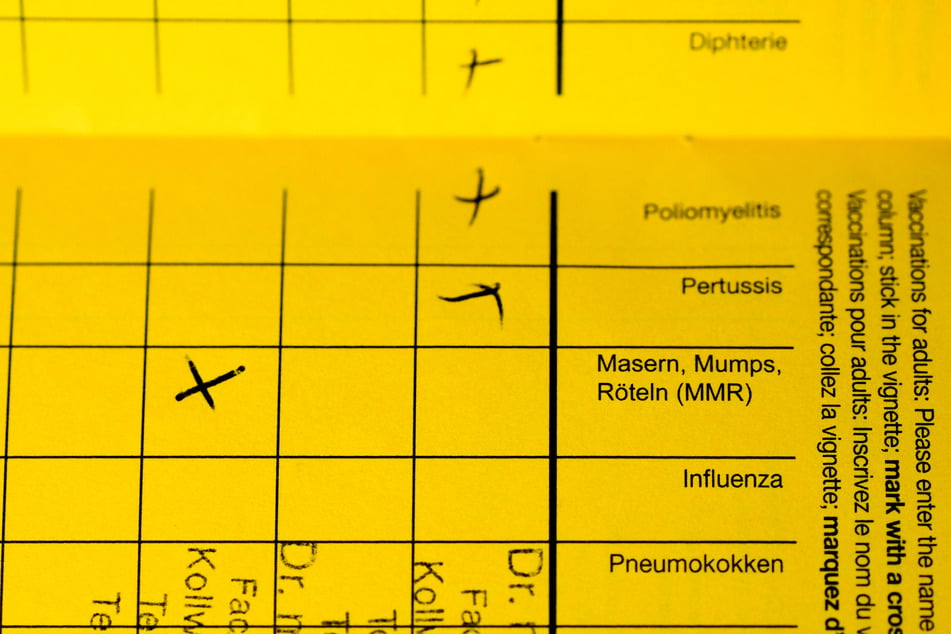 Die Zahl der Masernfälle in NRW ist im Corona-Jahr sehr niedrig. (Symbolbild)