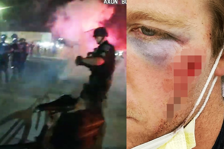 Krasses Video: So ist es für Polizisten, mit Feuerwerk beschossen zu werden!