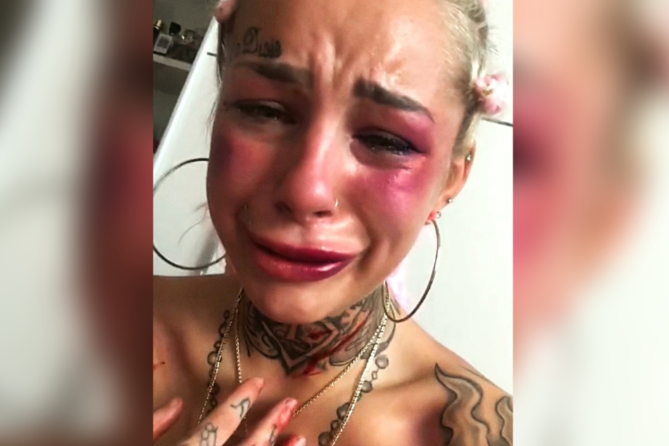 Ex-DSDS-Kandidation Leoni G (22) hat bei Instagram öffentlich gemacht, dass sie Opfer von häuslicher Gewalt geworden ist.