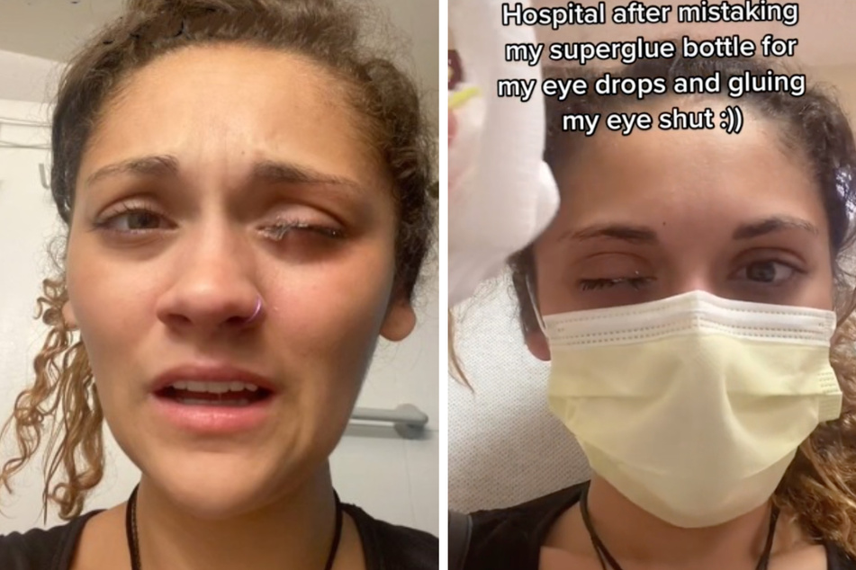 Lydia Hartmann (22) verwechselte Augentropfen mit Sekundenkleber. Sie kam ins Krankenhaus.