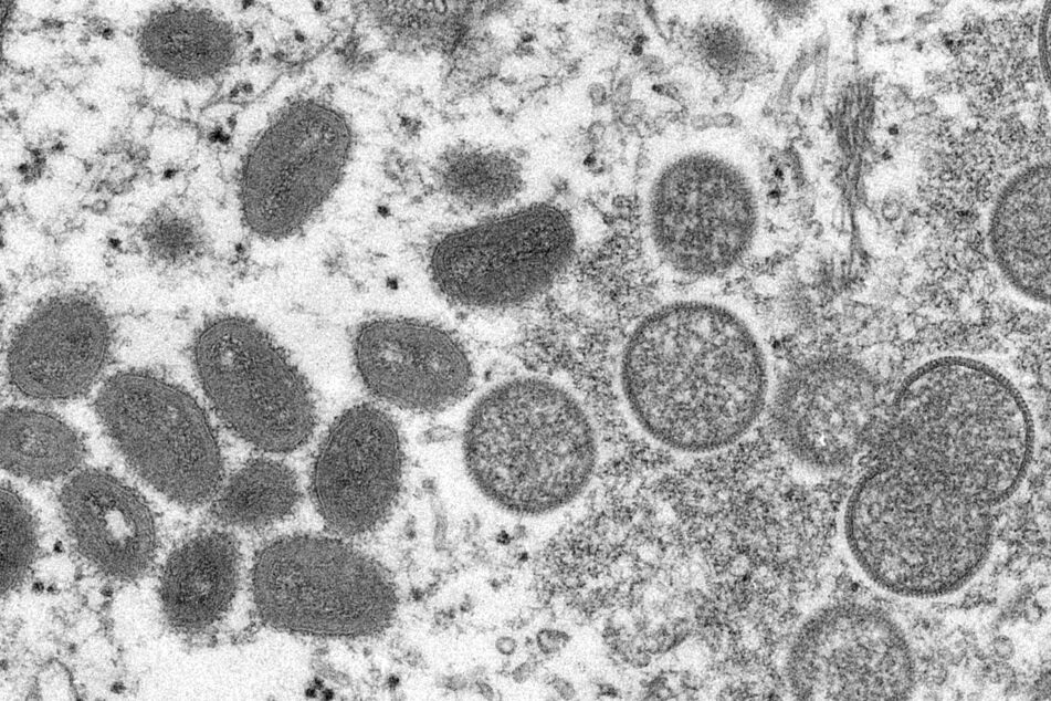 Reife, ovale Affenpockenviren (l.) und kugelförmige unreife Virionen (r.) unter einem Mikroskop.