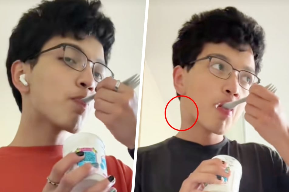 Felipe (19) stellte im Vergleich mit früheren Aufnahmen (l.) fest, dass er eine Schwellung am Hals hatte.