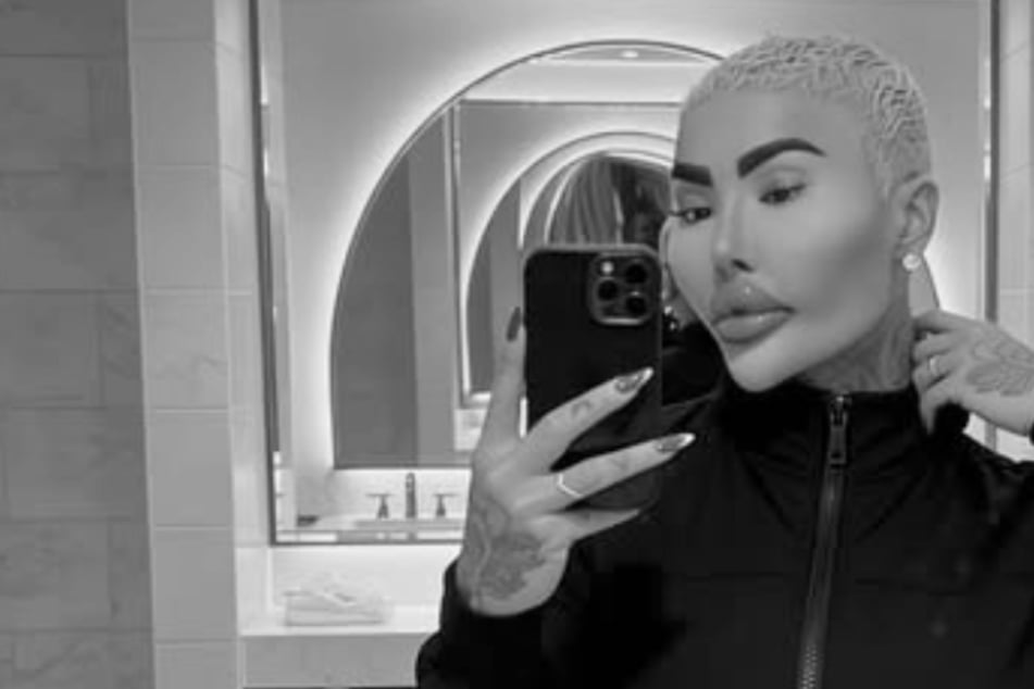 War eine Schönheit-OP schuld? Influencer stirbt mit 34 Jahren, zwei Personen festgenommen