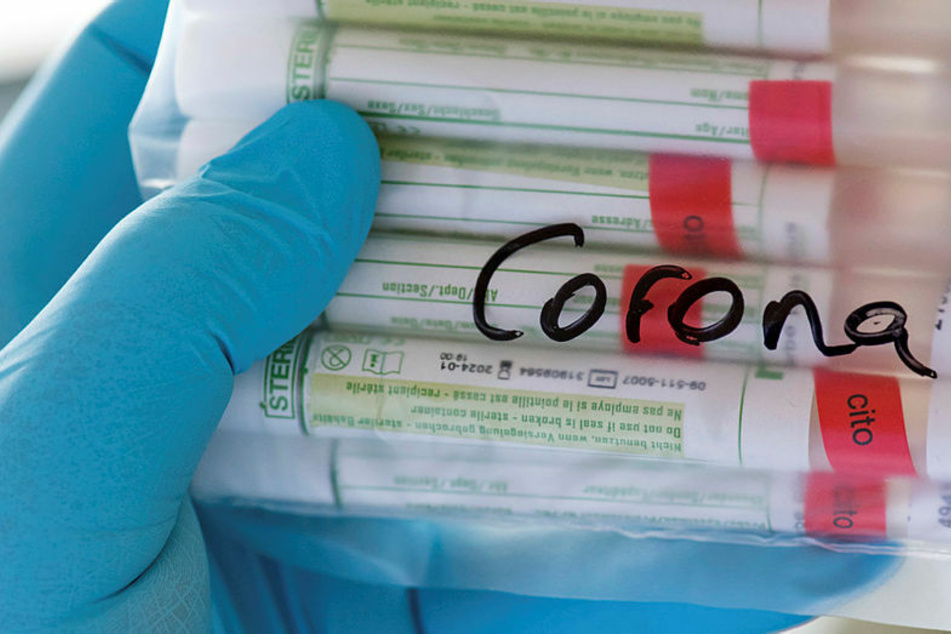 Der für die Getesteten aktuell kostenlose Corona-Test schlägt mit 65,50 Euro zu Buche. Der Freistaat und die Kassenärztliche Vereinigung Sachsen teilen sich in die Kosten.