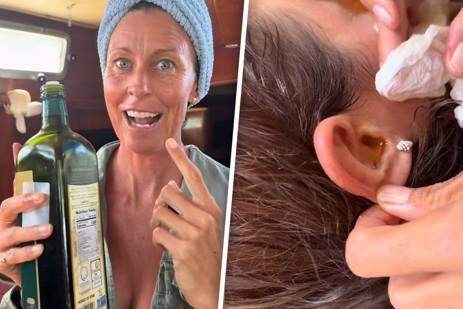 Mit ein wenig Olivenöl gelang es schließlich, den ungebetenen Gast aus dem Ohr zu bekommen.