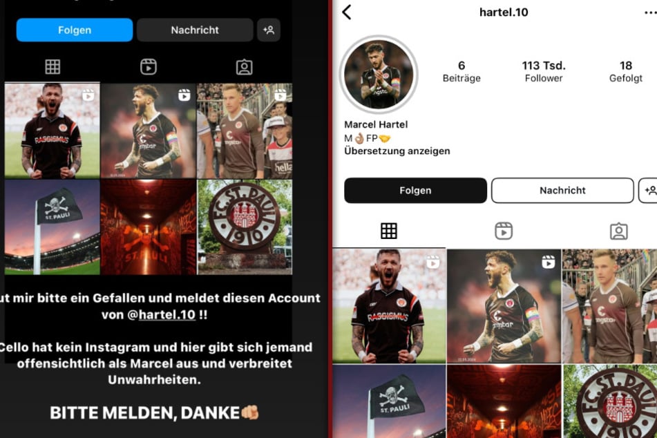 Nicht so echt wie es scheint. Ein vermeintliches Instagram-Profil von Marcel Hartel (28) erweist sich als Fälschung.