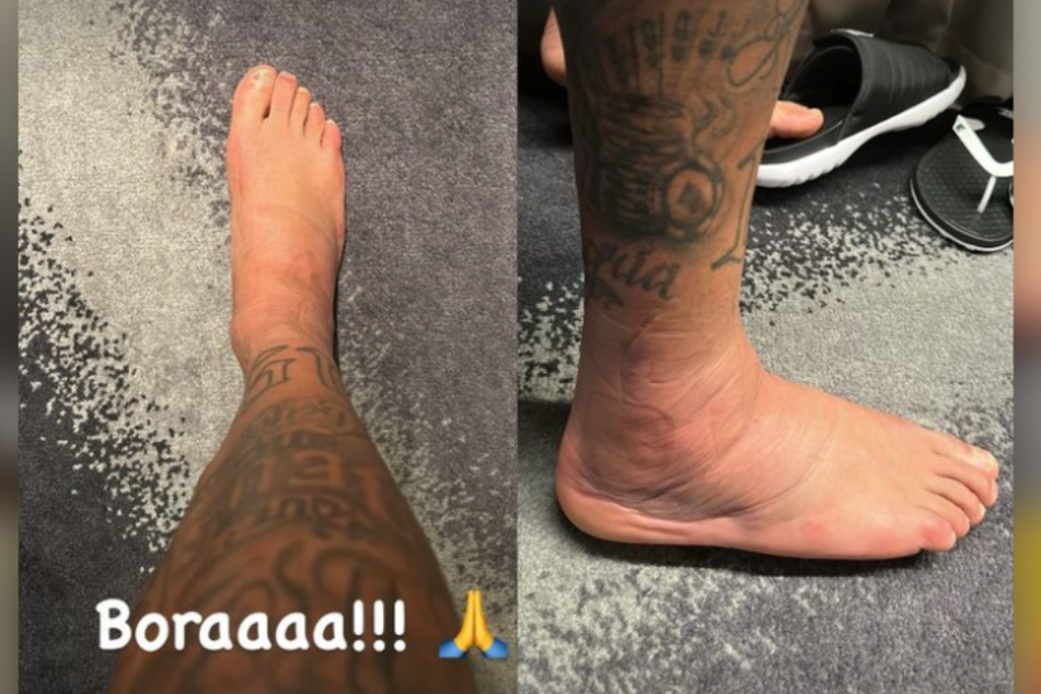 Die Fuß-Bilder von Superstar Neymar geben wenig Anlass zur Hoffnung.