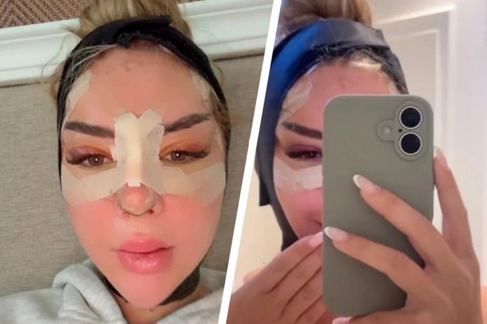 Influencerin Emma Fernlund (24) hat sich drei Beauty-OPs auf einmal unterzogen und damit im Netz für Aufregung gesorgt. (Archivbild)