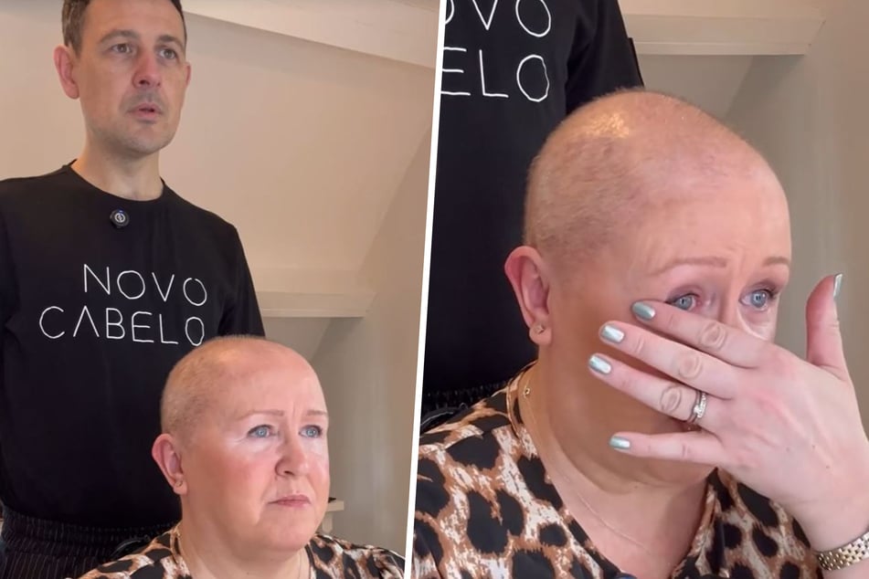 Jill is desperate after chemotherapy because her hair is not coming back.