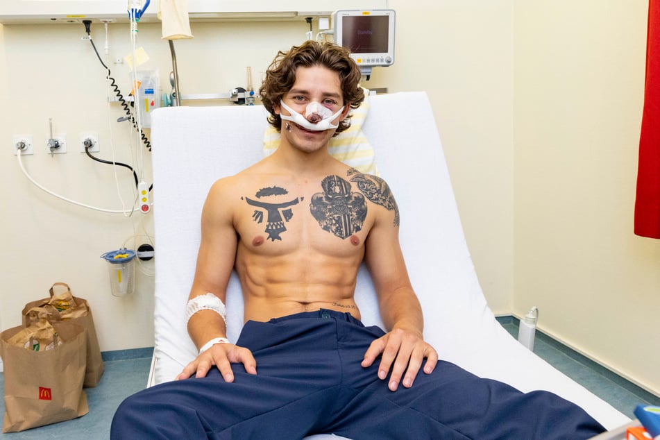 John Rudat musste im Krankenhaus operiert werden. Die Narben im Gesicht werden bleiben.