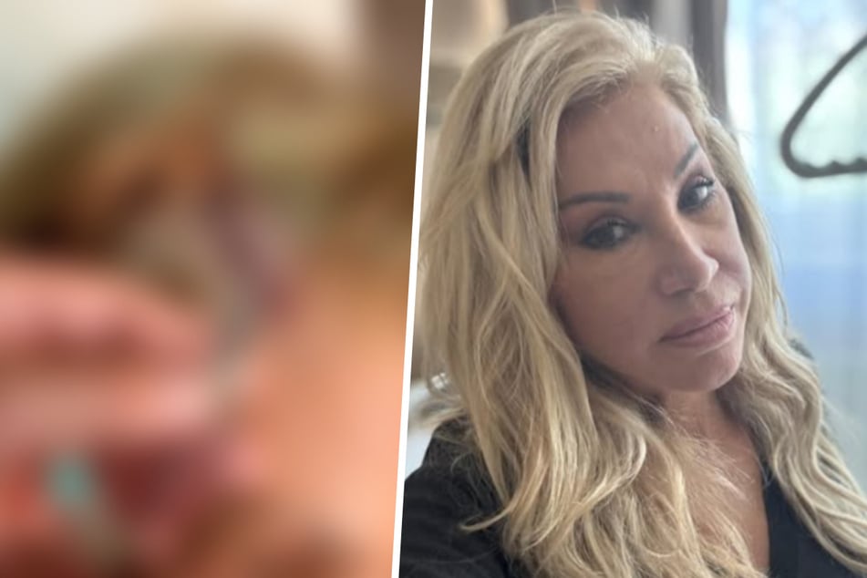 Carmen Geiss: Nichts für schwache Nerven: Carmen Geiss zeigt Horror-Narbe von ihrer Hirn-OP