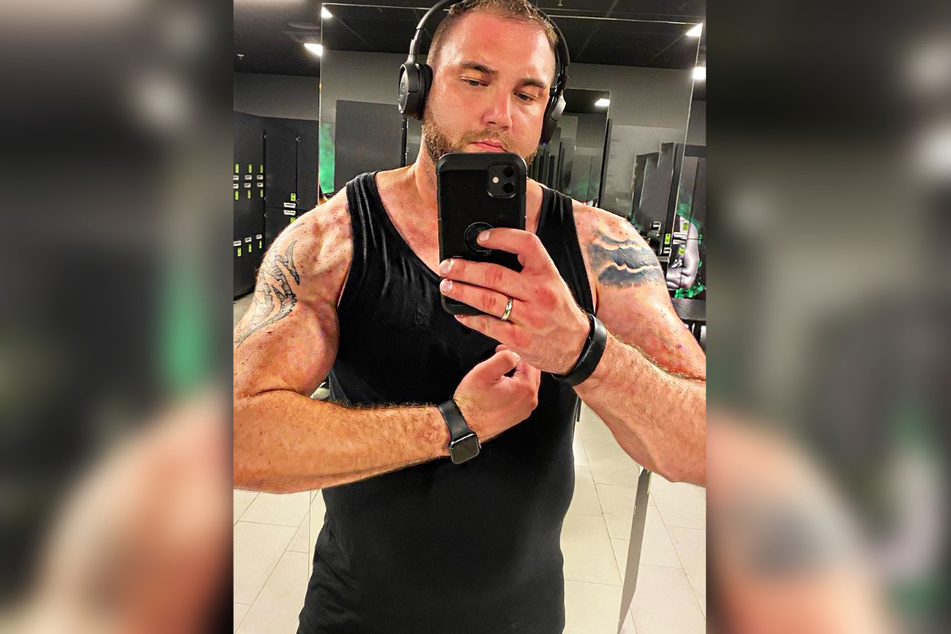 Sport kann Philipp noch nicht wieder machen - nach seinem Laufunfall im März schmerzt sein Knie noch immer.