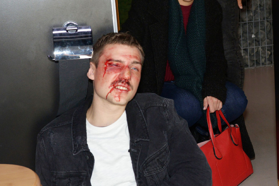 Moritz wird von Nils zusammengeschlagen.