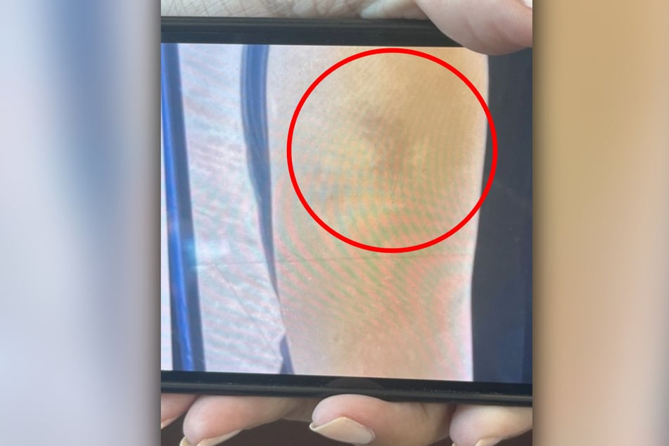 Une photo de la blessure a circulé peu après l'incident sur la plateforme X.