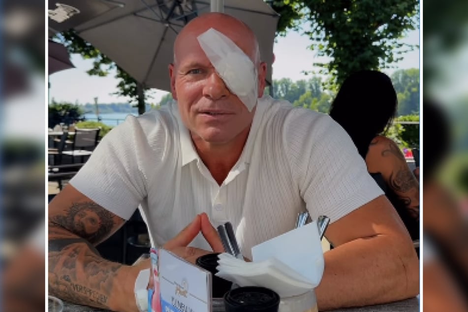 Gut gelaunt trotz lädiertem Auge grüßte Thorsten Legat (56) am Montagnachmittag seine Fans bei Instagram.