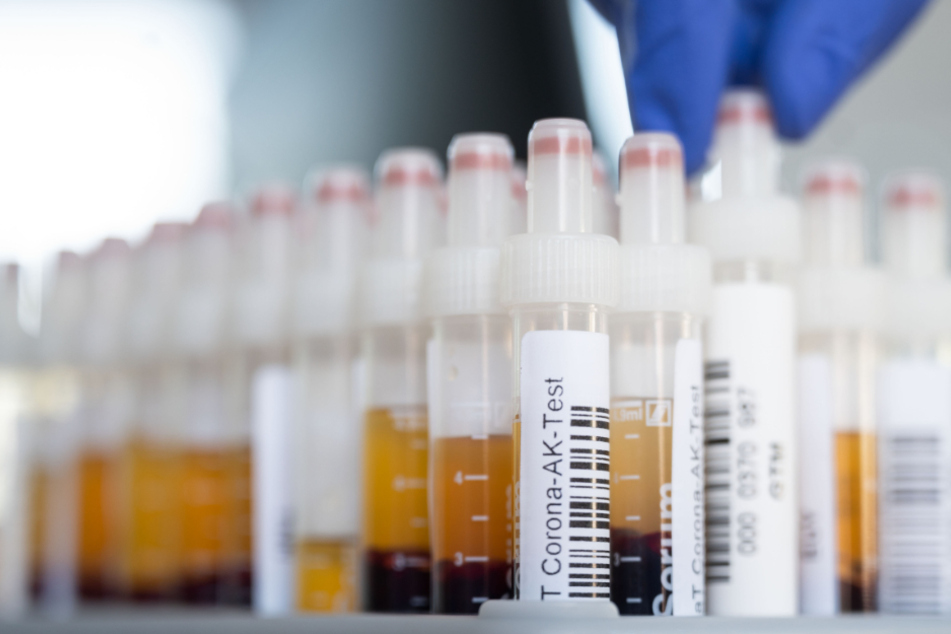 Aktuelle Corona-Tests werden damit für Reisende aus Infektions-Hotspots unabdingbar.