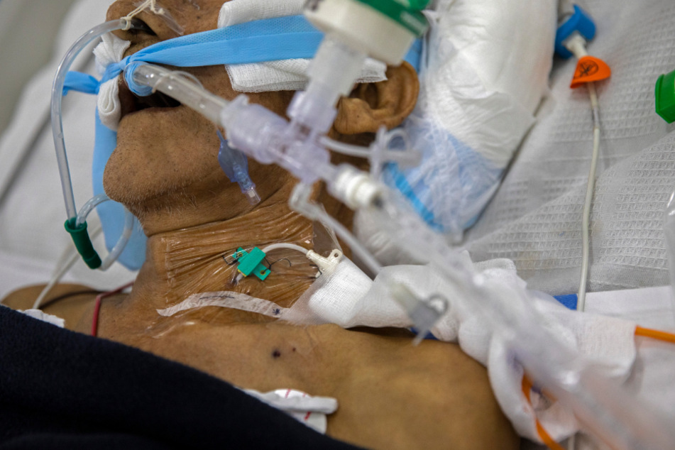 Ein Covid-19-Patient hängt auf einer Intensivstation an einem Beatmungsgerät.