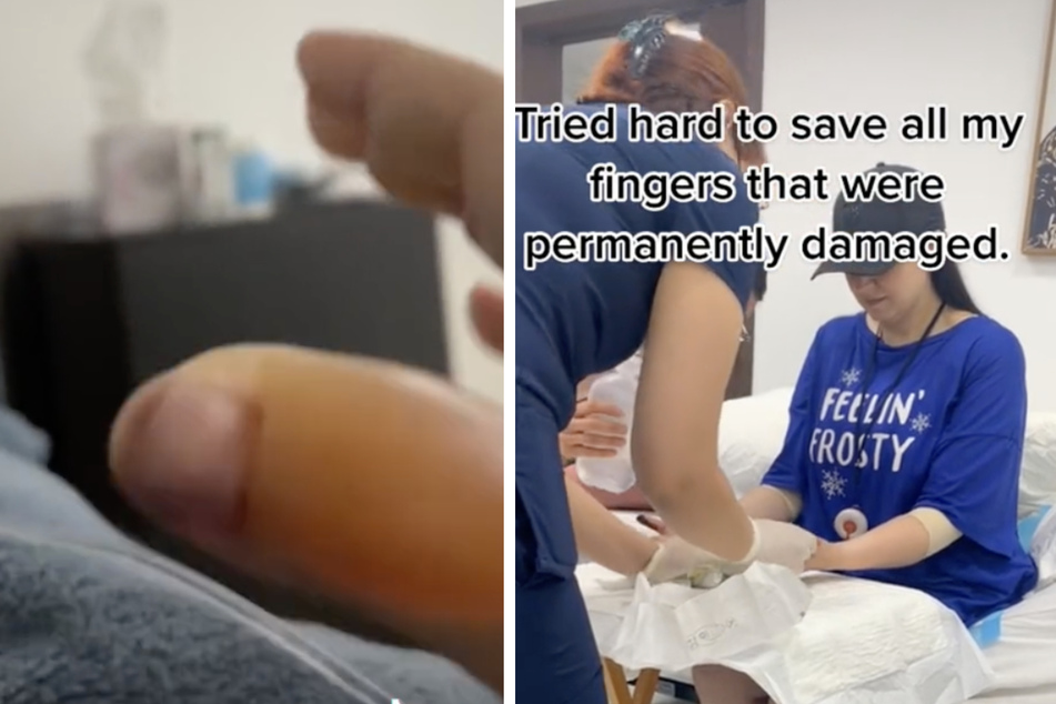 Nach der Beauty-OP mussten Teile ihrer Hände amputiert werden.