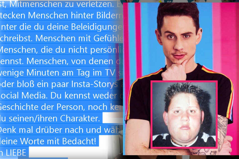 Pat (31) reicht's! Er richtet eindringliche Worte an alle Hetzer und Hater.