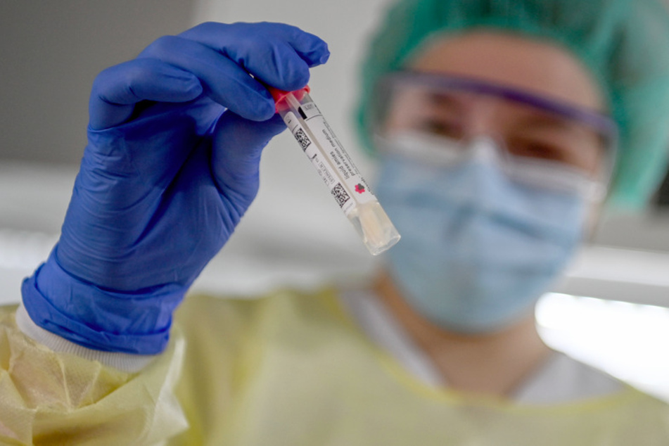 Eine Assistentin hält ein Röhrchen mit dem Tupfer für den PCR-Test in der Hand.