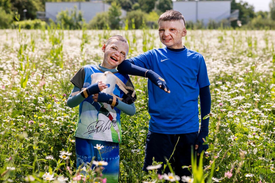 Der zweite Preis beim Wettbewerb "NRW-Pressefoto 2025" geht an Michael Bause, der für den "Kölner Stadt-Anzeiger" zwei lebensfrohe, aber im russischen Krieg gegen die Ukraine schwer verletzte Jungen fotografiert hat.