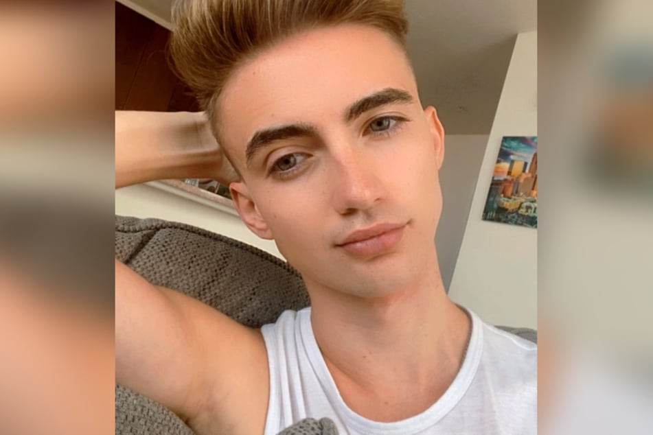 Tyler Dyvig (23) ließ sich mit 15 das erste Mal Botox spritzen.