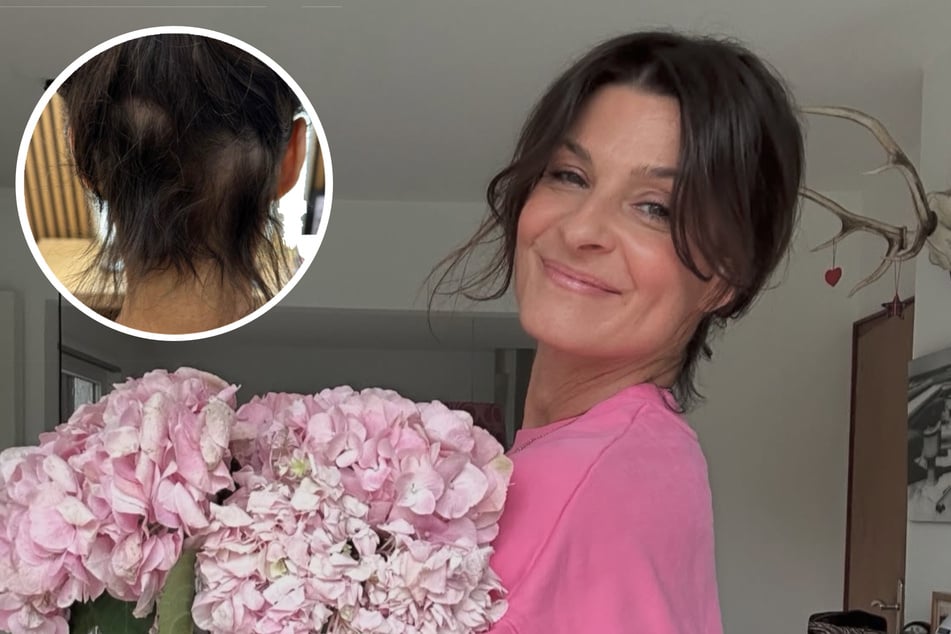Beim Eintreten ihrer Menopause hatte Marlene Lufen (54) mit starkem Haarausfall zu kämpfen.