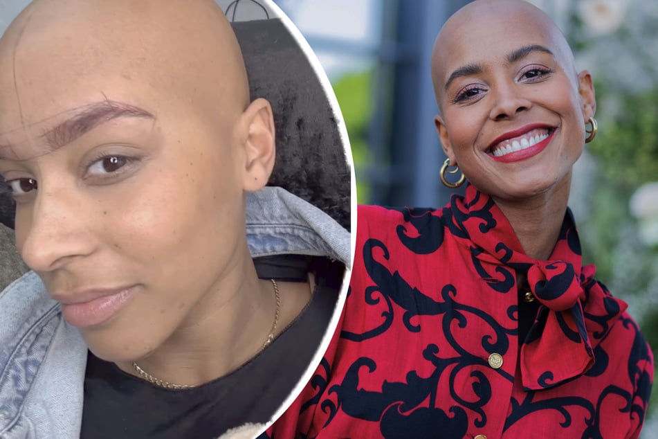 Aufgrund der Folgen ihrer Krankheit ließ sich Sharon Battiste (34) die Augenbrauen richten.