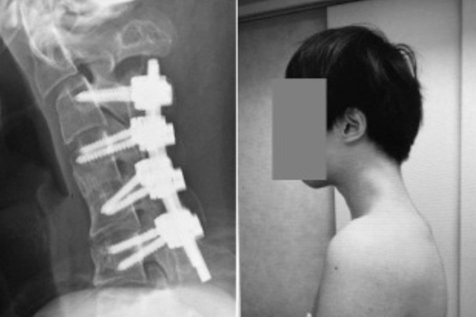 Die Ärzte konnten dem Patienten helfen.