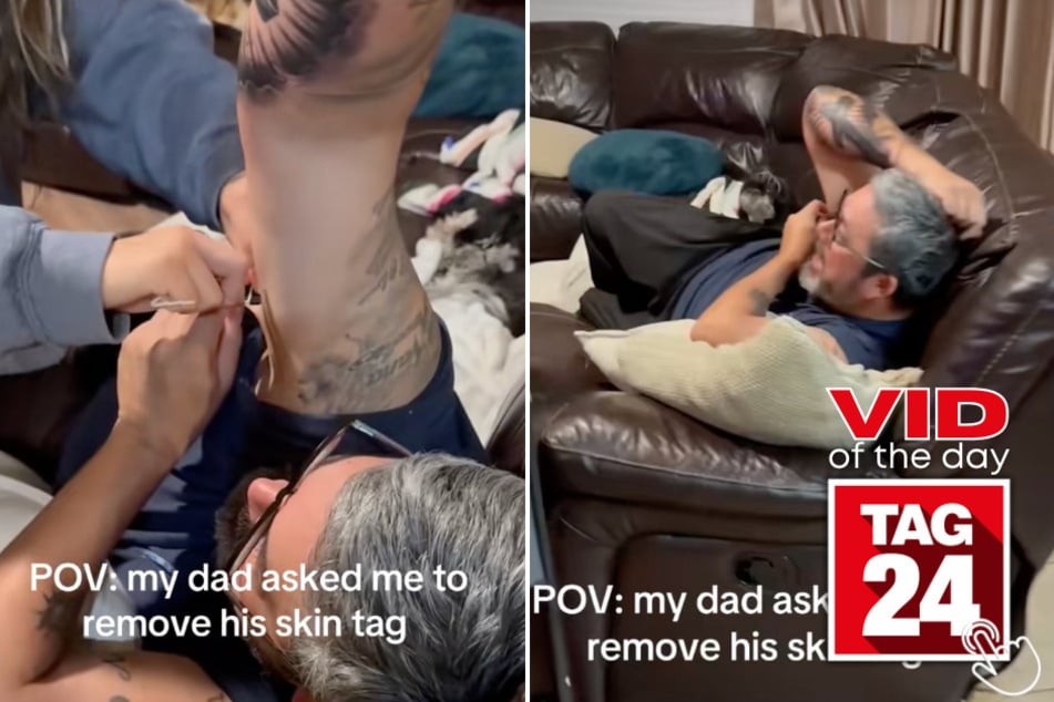 This girl tried to remove her father's skin tag, and he was not ready for the horror.