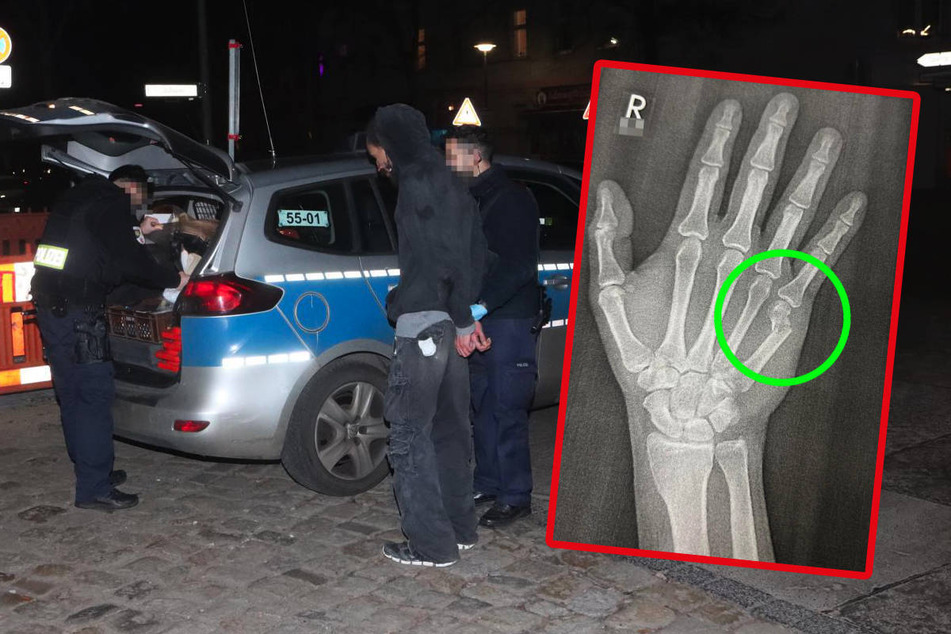 Berlin: 35-Jähriger wehrt sich gegen Festnahme und bricht Polizisten die Hand