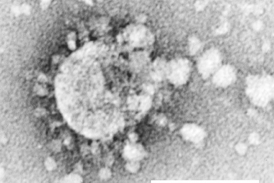 Eine Aufnahme des Coronavirus unter dem Mikroskop.