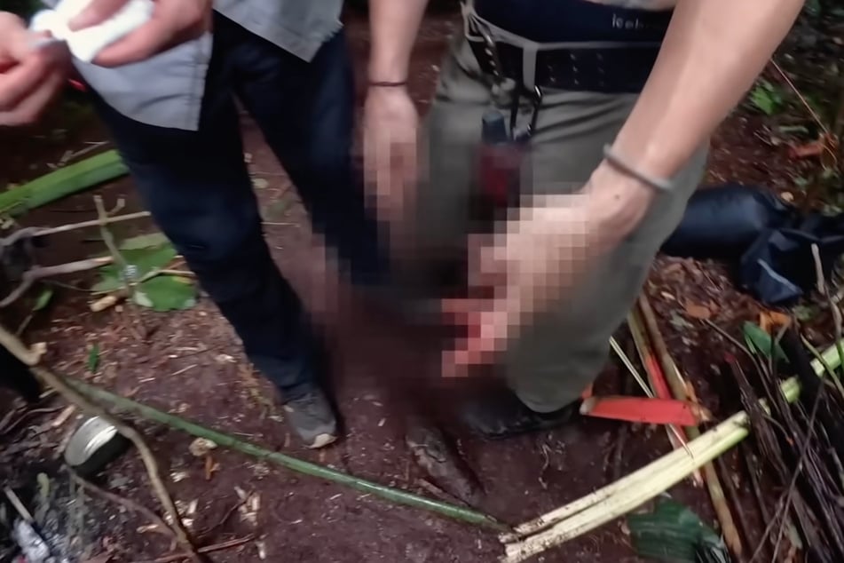 Sie war mit dem Messer abgerutscht und hat sich geschnitten.