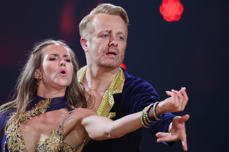 Sänger Ross Antony (51) wurde beim Tanz vom Ellenbogen seiner Tanzpartnerin getroffen und zog sich eine Platzwunde zu.