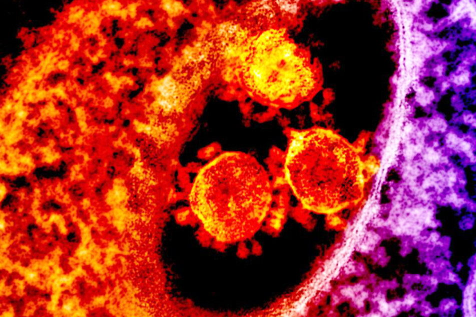 Eine Ansicht dreier Coronaviren unter einem Elektronenmikroskop.