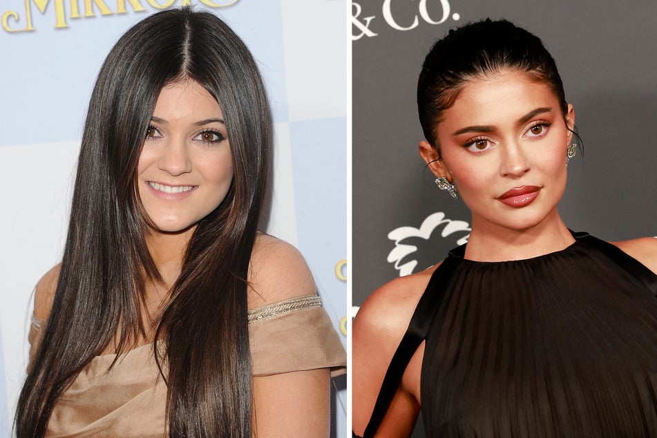 Kylie Jenner looks quite different then and now, and fans seem convinced the reality star has had done more procedures to her face than lip filler.