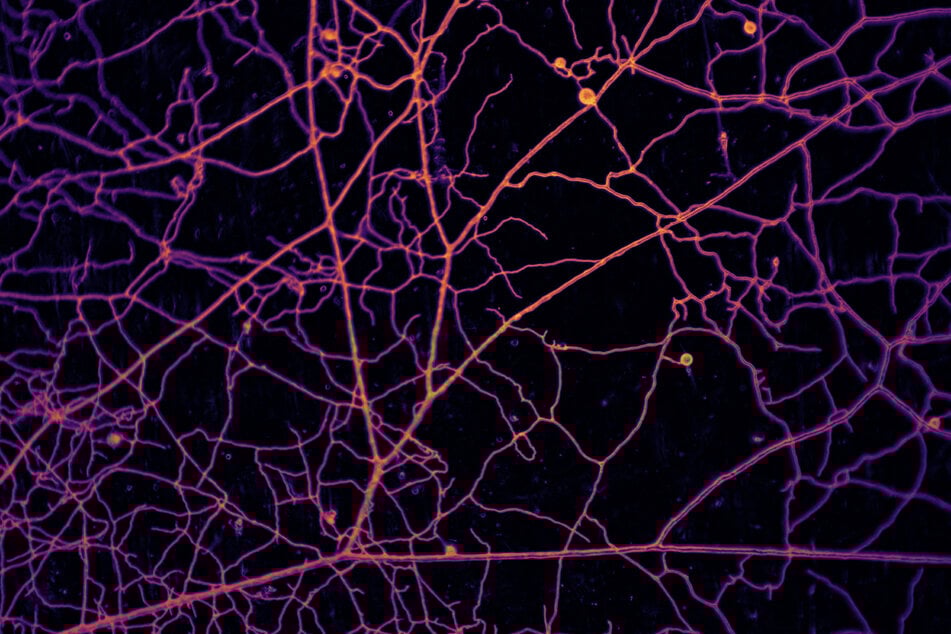 A picture provided by the Vrije Universiteit Amsterdam shows a microscopic image of a network formed by arbuscular mycorrhizal fungi.