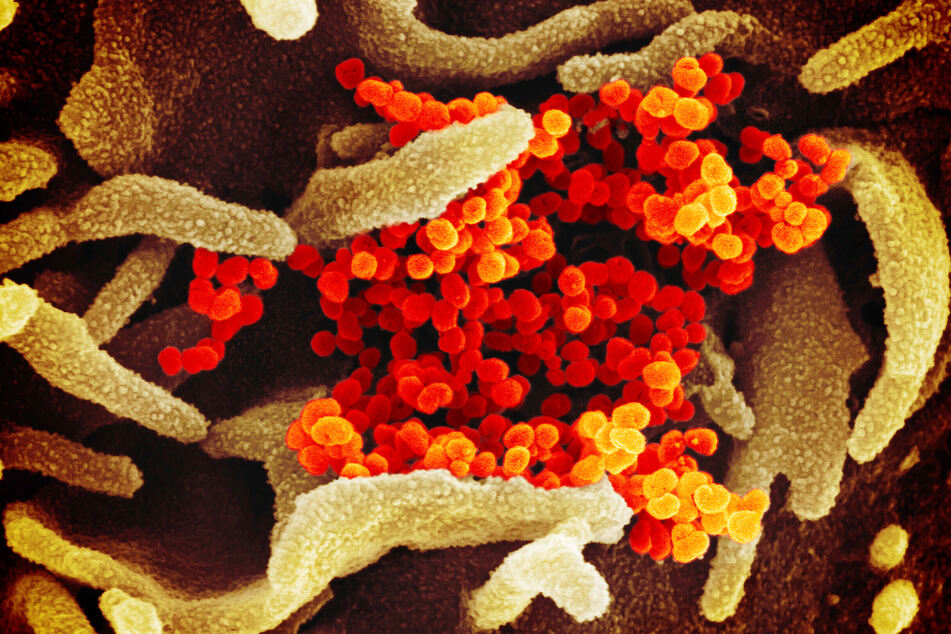 Diese rasterelektronenmikroskopische Aufnahme zeigt SARS-CoV-2 (orange), das COVID-19 verursacht.