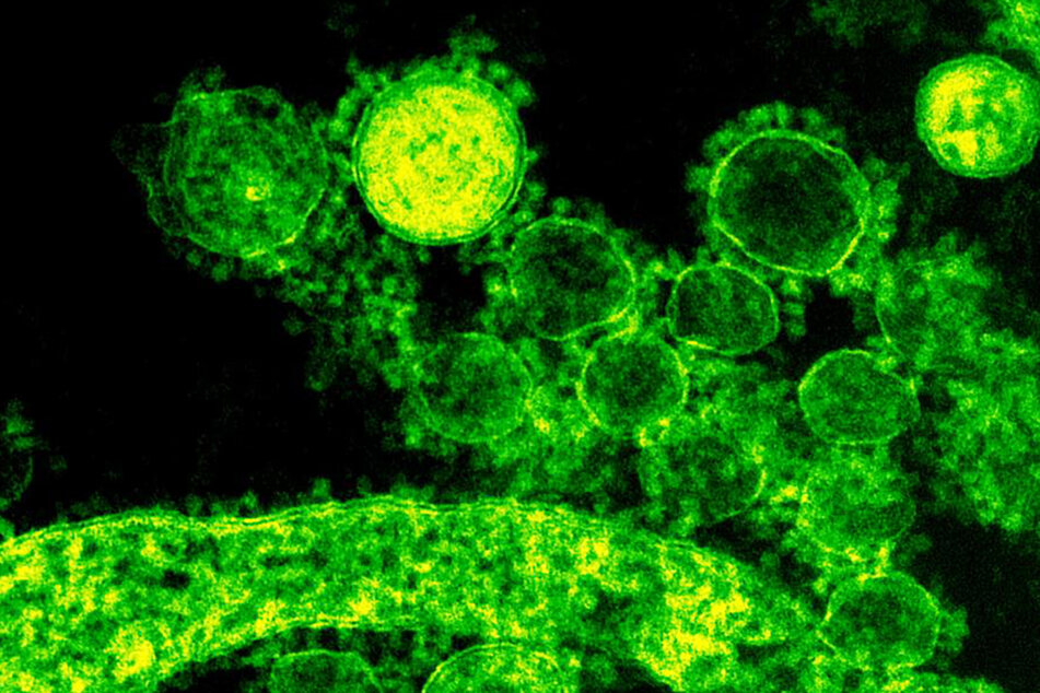 Eine mikroskopische Abbildung des Coronavirus.