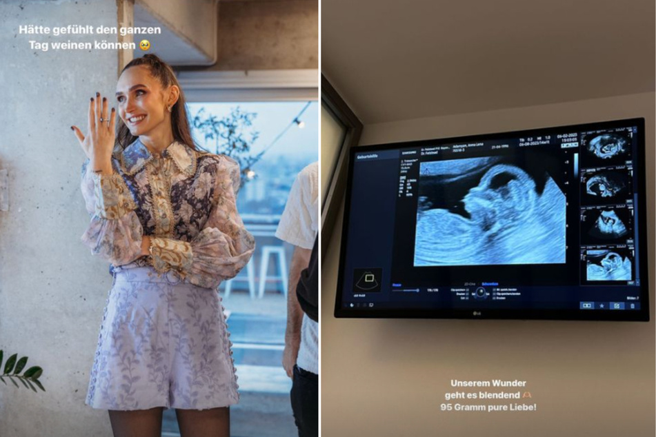 Anna Adamyan verrät bei Instagram viele Details ihrer Schwangerschaft.