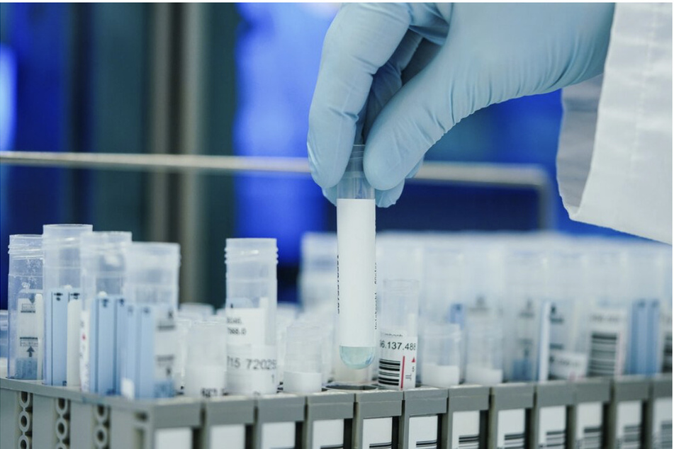 Bundesweit werden aktuell 5000 PCR-Tests pro Tag ausgewertet. (Symbolbild)