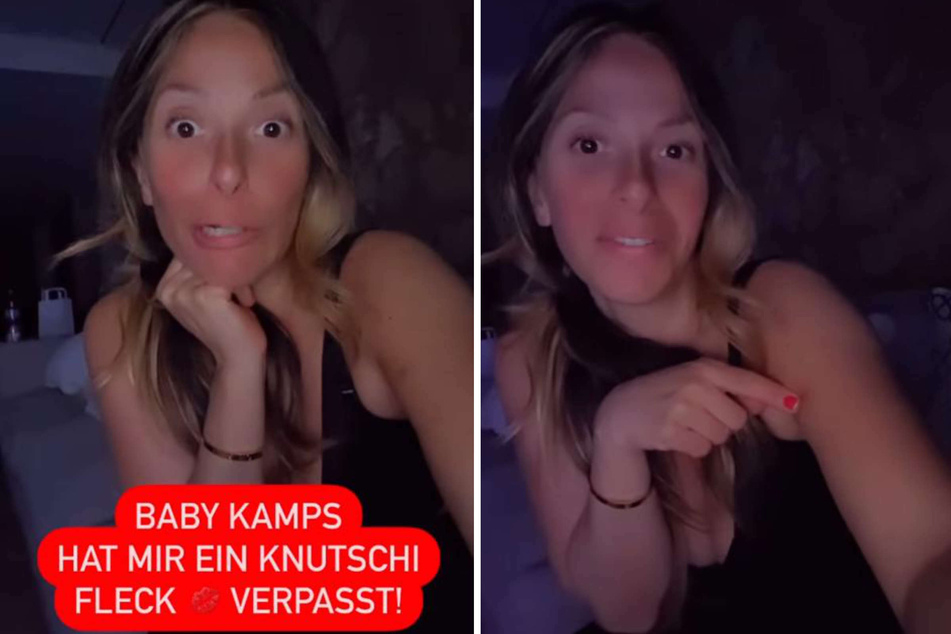 Gülcan Kamps (39) zeigte ihren Instagram-Fans den Knutschfleck (r.), den "Baby Kamps" seiner Mama verpasst hatte.