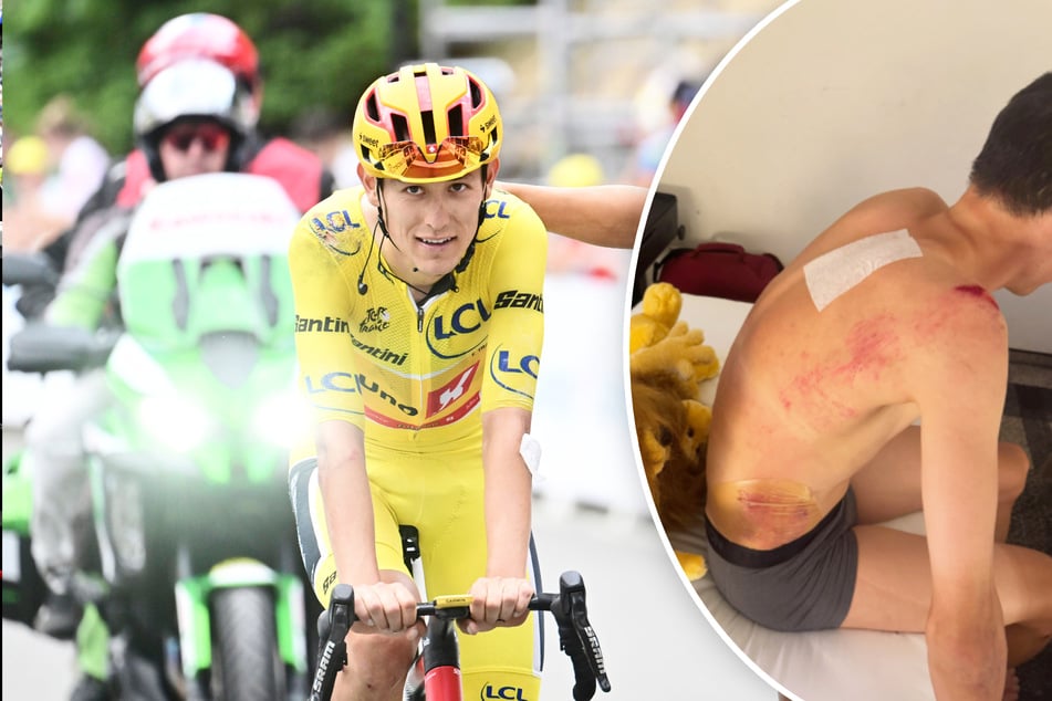 Schwer verletzt ins Ziel gequält! Schlimmer Sturz beendet Tour-de-France-Märchen